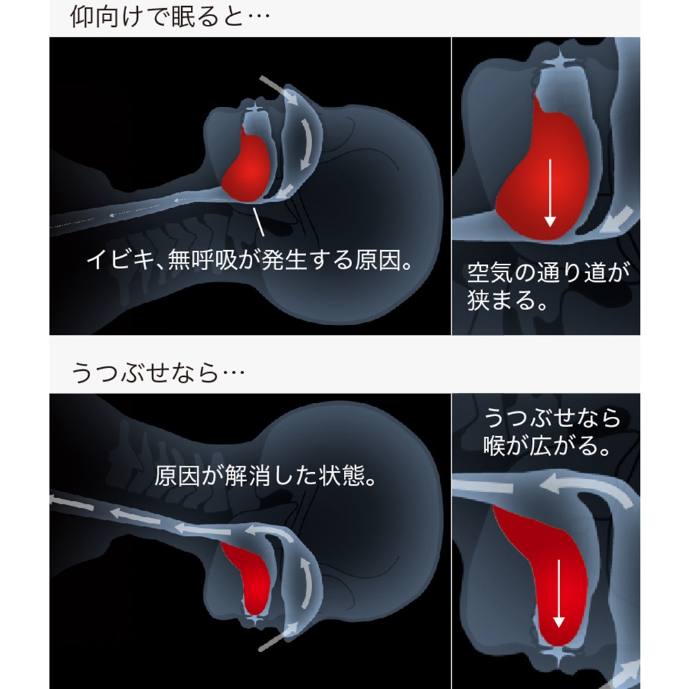 ドクタースミス Dr.Smith うつぶせ寝 枕(カバー付) - 枕